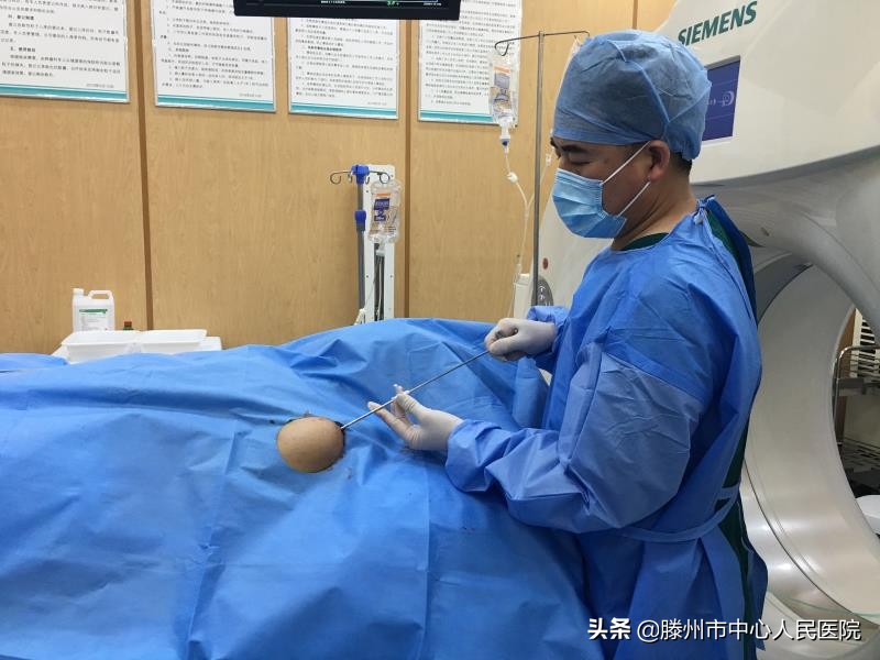 CT引導微波消融聯合鋼筋混凝土技術治療肱骨轉移技術在滕州開展